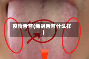 疫情舌苔(新冠舌苔什么样)