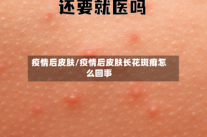 疫情后皮肤/疫情后皮肤长花斑癣怎么回事